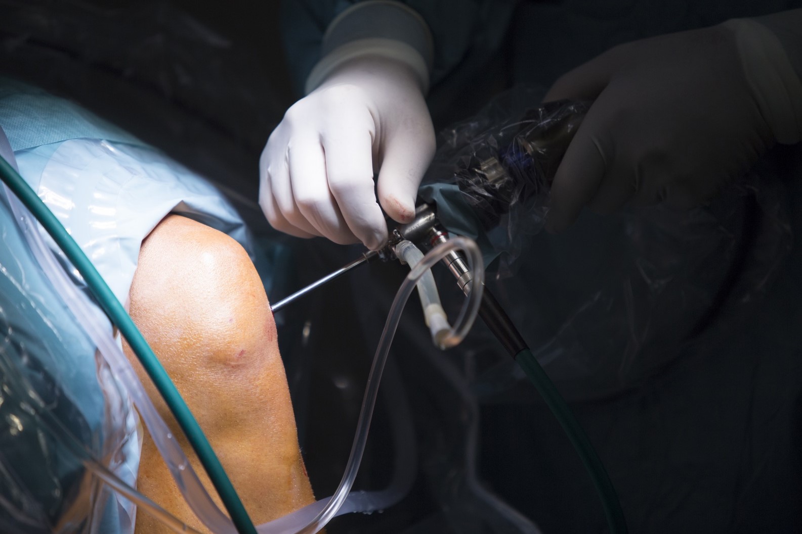 traumatology surgeon in Almería - arthroscopy