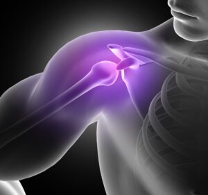 Shoulder arthroscopy in Almeria - man