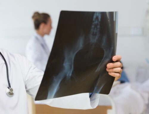 Traumatologist in Almeria for hip injuries: specialised evaluation and treatment