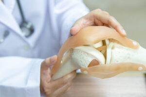 traumatólogo en Málaga - explicación